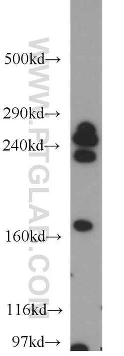 CNOT1 Rabbit anti-Human, Mouse, Rat, Polyclonal, Proteintech:Antibodies:Primary