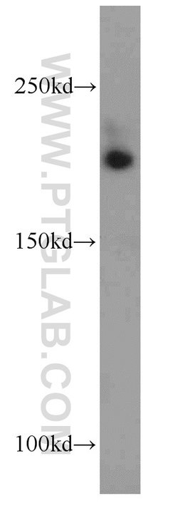 CNOT1 Rabbit anti-Human, Mouse, Rat, Polyclonal, Proteintech:Antibodies:Primary