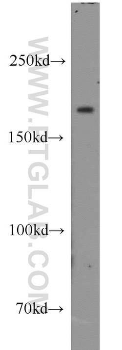 CNOT1 Rabbit anti-Human, Mouse, Rat, Polyclonal, Proteintech:Antibodies:Primary