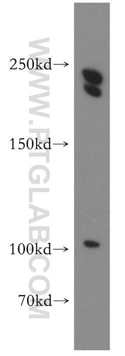 CNOT1 Rabbit anti-Human, Mouse, Rat, Polyclonal, Proteintech:Antibodies:Primary