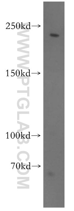 CNOT1 Rabbit anti-Human, Mouse, Rat, Polyclonal, Proteintech:Antibodies:Primary