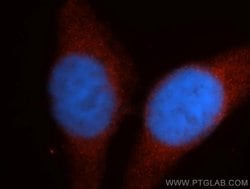 Proteintech Renin Rabbit anti-Human, Mouse, Rat, Polyclonal, Proteintech