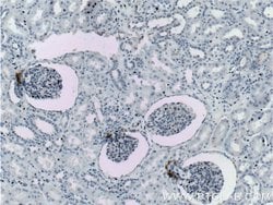 Renin Rabbit anti-Human, Mouse, Rat, Polyclonal, Proteintech:Antibodies:Primary