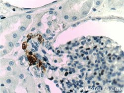 Renin Rabbit anti-Human, Mouse, Rat, Polyclonal, Proteintech:Antibodies:Primary