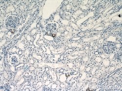 Renin Rabbit anti-Human, Mouse, Rat, Polyclonal, Proteintech:Antibodies:Primary