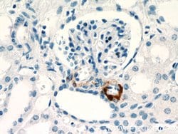 Renin Rabbit anti-Human, Mouse, Rat, Polyclonal, Proteintech:Antibodies:Primary