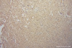 Renin Rabbit anti-Human, Mouse, Rat, Polyclonal, Proteintech:Antibodies:Primary