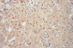 Renin Rabbit anti-Human, Mouse, Rat, Polyclonal, Proteintech:Antibodies:Primary