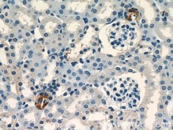 Renin Rabbit anti-Human, Mouse, Rat, Polyclonal, Proteintech:Antibodies:Primary