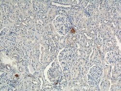 Renin Rabbit anti-Human, Mouse, Rat, Polyclonal, Proteintech:Antibodies:Primary