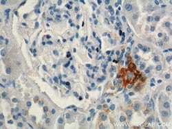 Renin Rabbit anti-Human, Mouse, Rat, Polyclonal, Proteintech:Antibodies:Primary