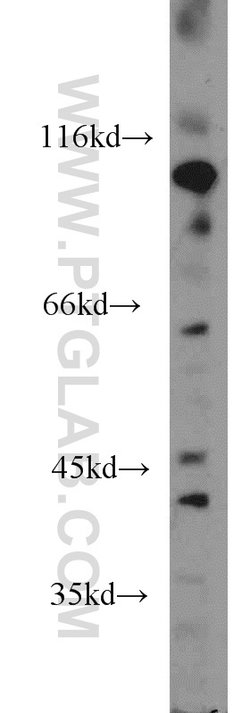 Renin Rabbit anti-Human, Mouse, Rat, Polyclonal, Proteintech:Antibodies:Primary