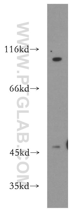 Renin Rabbit anti-Human, Mouse, Rat, Polyclonal, Proteintech:Antibodies:Primary
