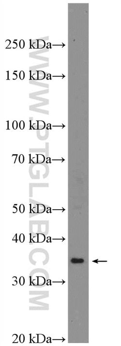Renin Rabbit anti-Human, Mouse, Rat, Polyclonal, Proteintech:Antibodies:Primary