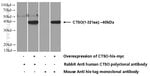 Thumbnail_CTSO Rabbit anti-Human, Mouse, Rat, Polyclonal, Proteintech 150 &mu;L;