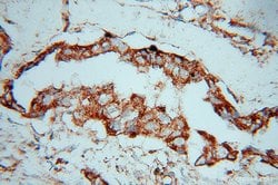 SLC38A3 Rabbit anti-Human, Mouse, Rat, Polyclonal, Proteintech 150 &mu;L;