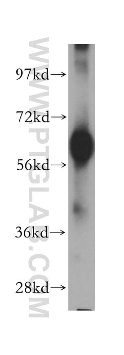 SLC38A3 Rabbit anti-Human, Mouse, Rat, Polyclonal, Proteintech 150 &mu;L;