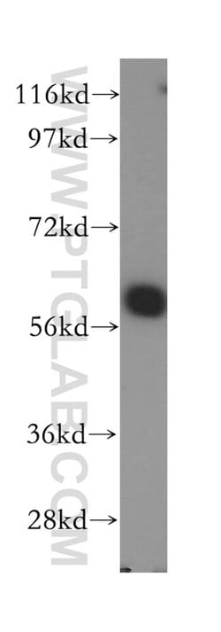 SLC38A3 Rabbit anti-Human, Mouse, Rat, Polyclonal, Proteintech 150 &mu;L;