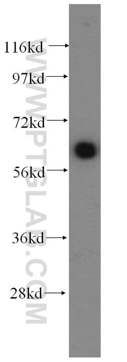 SLC38A3 Rabbit anti-Human, Mouse, Rat, Polyclonal, Proteintech 150 &mu;L;