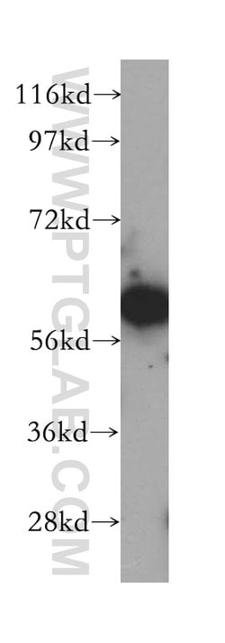 SLC38A3 Rabbit anti-Human, Mouse, Rat, Polyclonal, Proteintech 150 &mu;L;