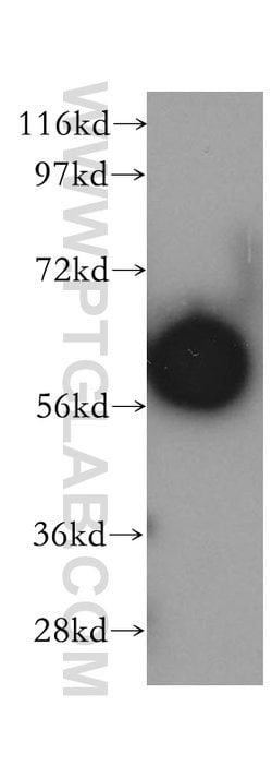 SLC38A3 Rabbit anti-Human, Mouse, Rat, Polyclonal, Proteintech 150 &mu;L;
