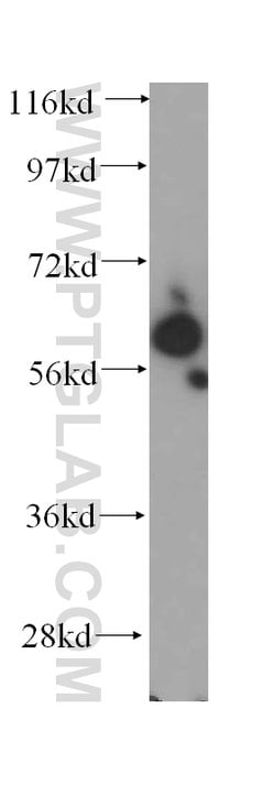 SLC38A3 Rabbit anti-Human, Mouse, Rat, Polyclonal, Proteintech 150 &mu;L;