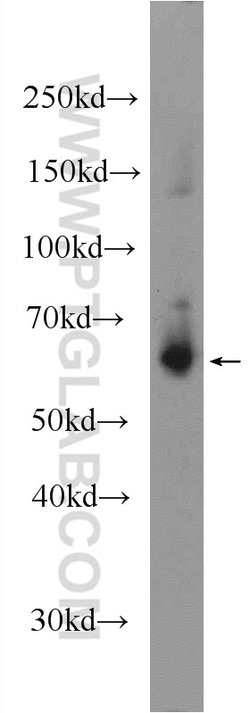 SLC38A3 Rabbit anti-Human, Mouse, Rat, Polyclonal, Proteintech 150 &mu;L;
