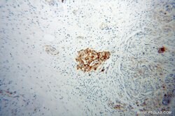 VWA1 Rabbit anti-Human, Mouse, Rat, Polyclonal, Proteintech 150 &mu;L;