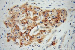 VWA1 Rabbit anti-Human, Mouse, Rat, Polyclonal, Proteintech 150 &mu;L;