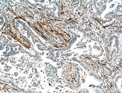VWA1 Rabbit anti-Human, Mouse, Rat, Polyclonal, Proteintech 150 &mu;L;
