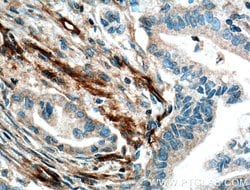 VWA1 Rabbit anti-Human, Mouse, Rat, Polyclonal, Proteintech 150 &mu;L;