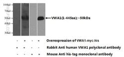 VWA1 Rabbit anti-Human, Mouse, Rat, Polyclonal, Proteintech 150 &mu;L;