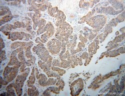 BCO2 Rabbit anti-Human, Mouse, Rat, Polyclonal, Proteintech 150 &mu;L;