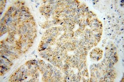 BCO2 Rabbit anti-Human, Mouse, Rat, Polyclonal, Proteintech 150 &mu;L;