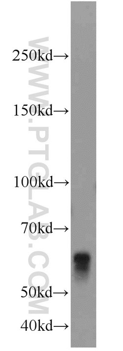 BCO2 Rabbit anti-Human, Mouse, Rat, Polyclonal, Proteintech 150 &mu;L;