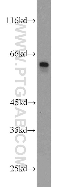 BCO2 Rabbit anti-Human, Mouse, Rat, Polyclonal, Proteintech 150 &mu;L;