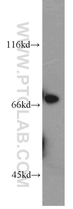 Collagen Type XXIII Rabbit anti-Human, Mouse, Rat, Polyclonal, Proteintech:Antibodies:Primary