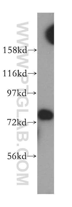 Collagen Type XXIII Rabbit anti-Human, Mouse, Rat, Polyclonal, Proteintech:Antibodies:Primary