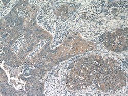 DIAPH3 Rabbit anti-Human, Polyclonal, Proteintech 150 &mu;L; Unconjugated:Antibodies,