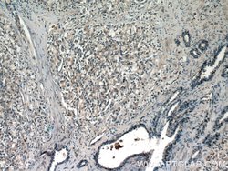 DIAPH3 Rabbit anti-Human, Polyclonal, Proteintech 150 &mu;L; Unconjugated:Antibodies,