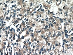 DIAPH3 Rabbit anti-Human, Polyclonal, Proteintech 150 &mu;L; Unconjugated:Antibodies,