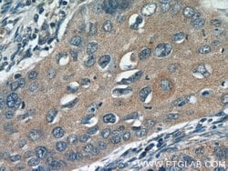 DIAPH3 Rabbit anti-Human, Polyclonal, Proteintech 150 &mu;L; Unconjugated:Antibodies,