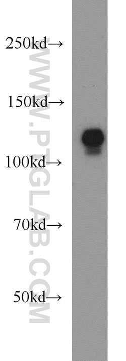 DIAPH3 Rabbit anti-Human, Polyclonal, Proteintech 150 &mu;L; Unconjugated:Antibodies,