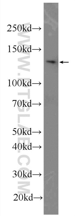 DIAPH3 Rabbit anti-Human, Polyclonal, Proteintech 150 &mu;L; Unconjugated:Antibodies,
