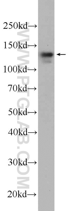DIAPH3 Rabbit anti-Human, Polyclonal, Proteintech 150 &mu;L; Unconjugated:Antibodies,