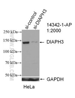 DIAPH3 Rabbit anti-Human, Polyclonal, Proteintech 150 &mu;L; Unconjugated:Antibodies,