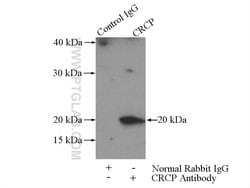 CRCP Rabbit anti-Human, Mouse, Rat, Polyclonal, Proteintech:Antikörper:Primärantikörper