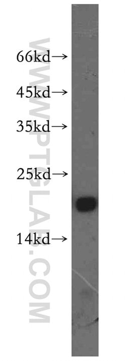 CRCP Rabbit anti-Human, Mouse, Rat, Polyclonal, Proteintech