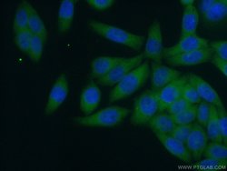 RABEP1 Rabbit anti-Human, Mouse, Rat, Polyclonal, Proteintech:Antibodies:Primary
