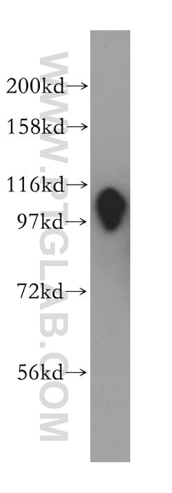 RABEP1 Rabbit anti-Human, Mouse, Rat, Polyclonal, Proteintech:Antibodies:Primary